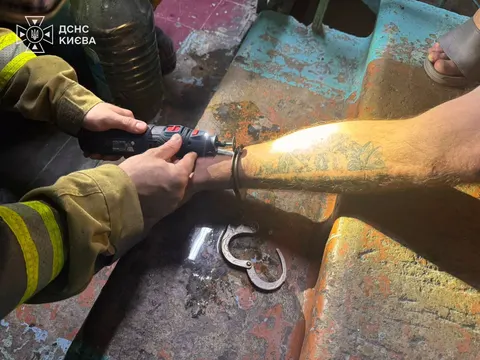 У Києві рятувальники вночі знімали кайданки з ноги чоловіка